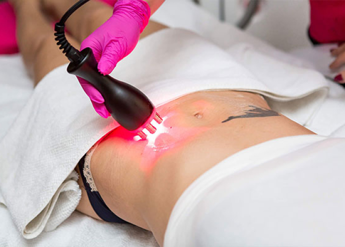 8. Eliminacja tkanki tłuszczowej fale RF plus ćwiczenia - pakiet nr 2